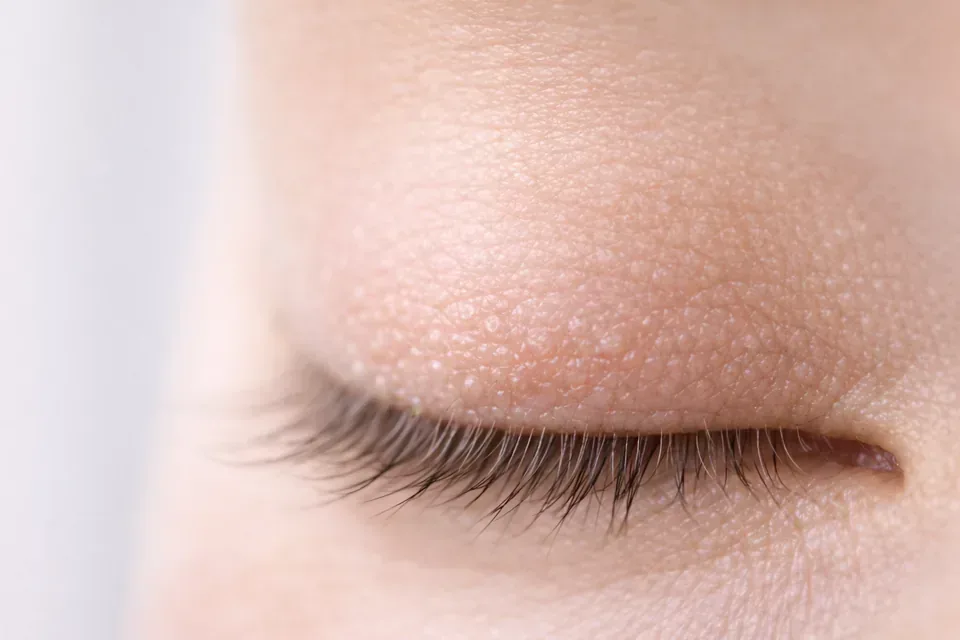 Causes & Risk Factors